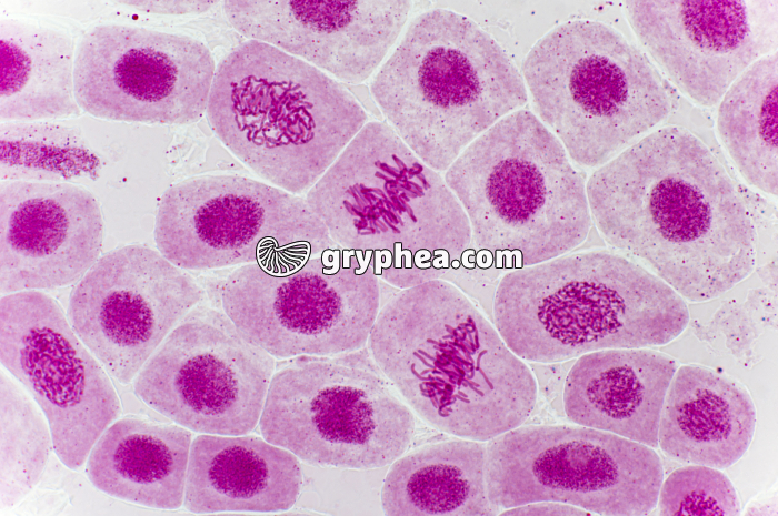 Mitose racine d'Ail (métaphases et prophases) coloration Carmin acétique x200 - gryphea.org